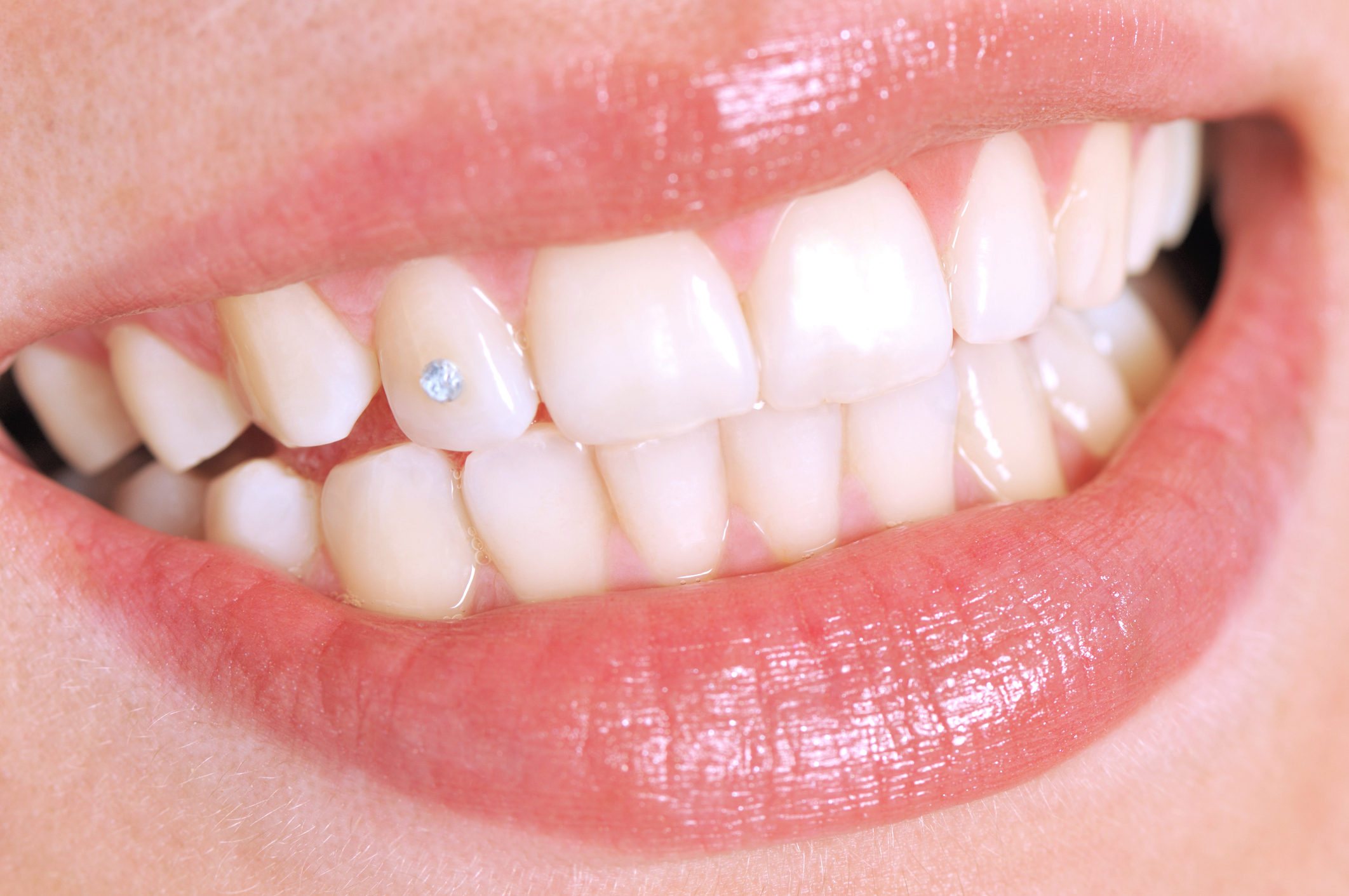 Tooth Gems GOLD Tooth Gems GOLD